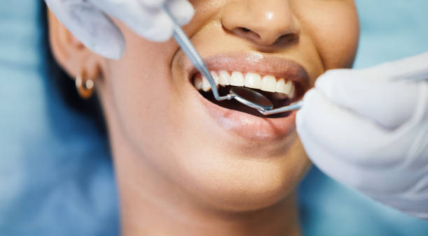 Best Weekend Emergency Dentist in Santa Ynez, CA