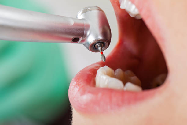 Best Weekend Emergency Dentist in Santa Ynez, CA